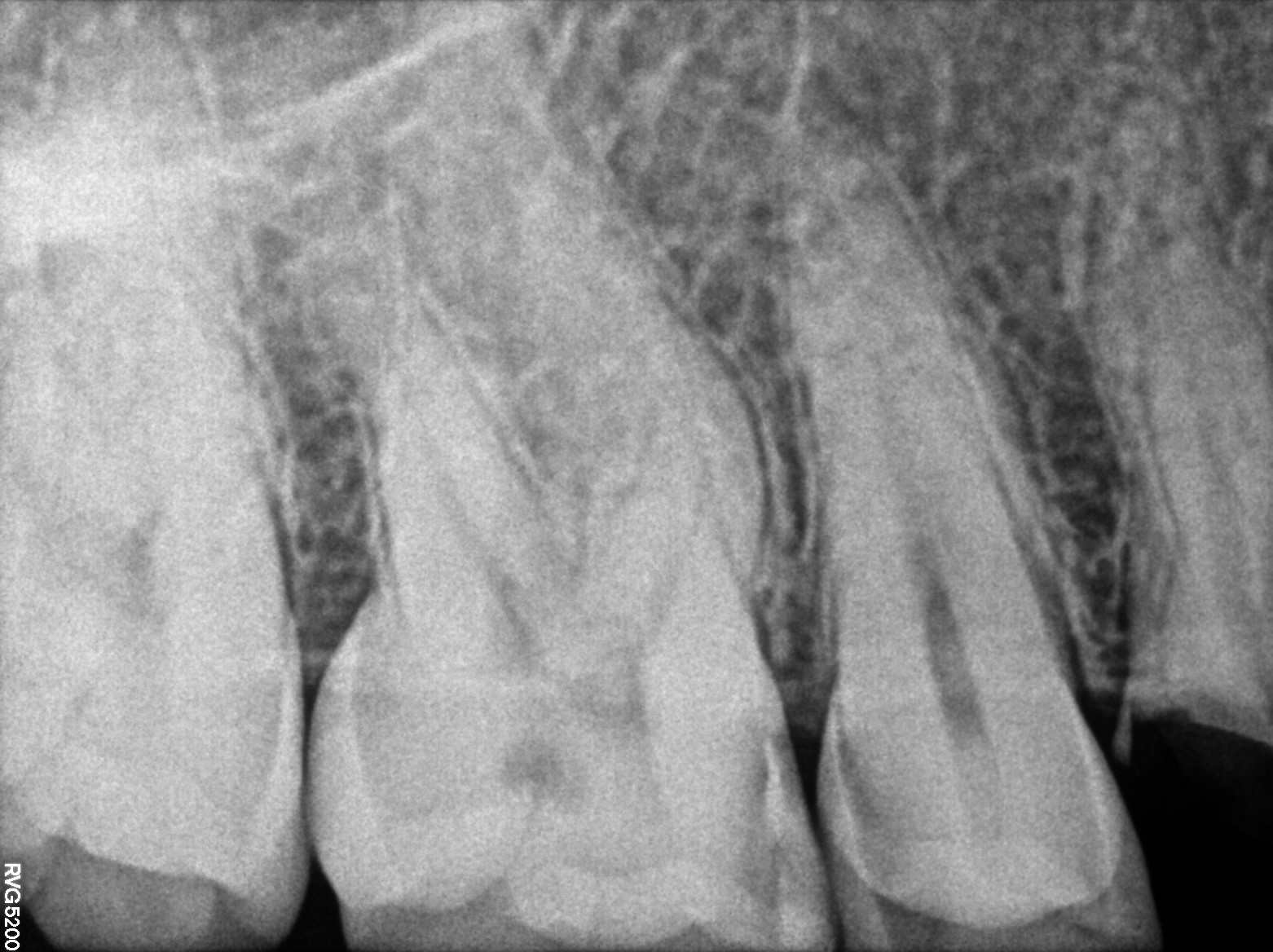Dental X-ray